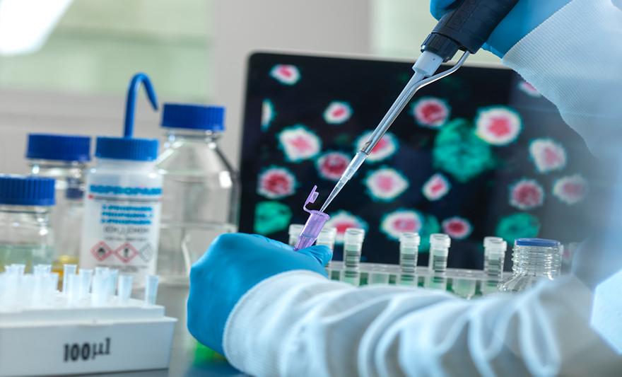 김욱·최상돈 교수팀, 자가면역질환 치료 위한 新 화합물 개발